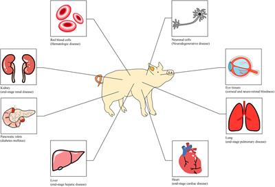 Genetically engineered pigs for xenotransplantation: Hopes and challenges